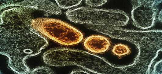 Nipah-Virus
